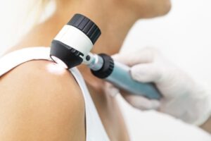 Ein Hautarzt untersucht die Muttermal auf der haut einer Patientin.